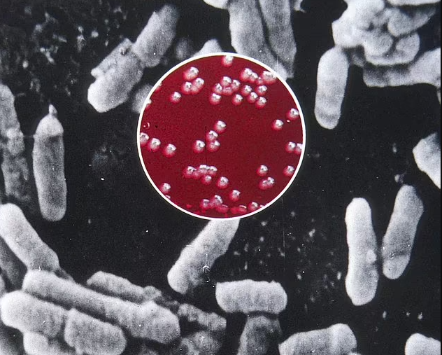 A New Mexico man has become the first to die of the plague in the US this year after contracting Yesinia Pestis bacteria
